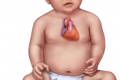 pediatric heart